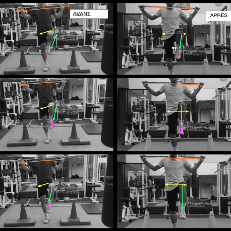 FMS - Hurdle step JG