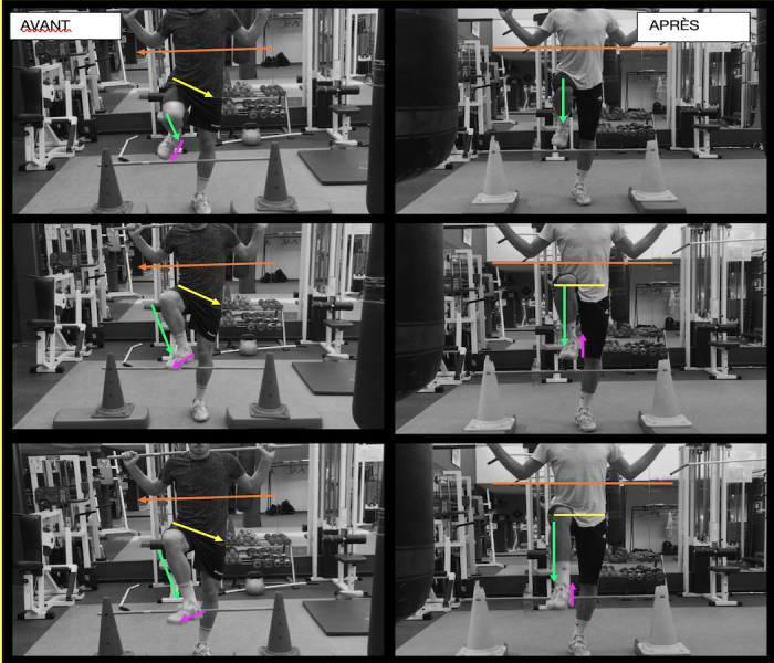 FMS - Hurdle step JD