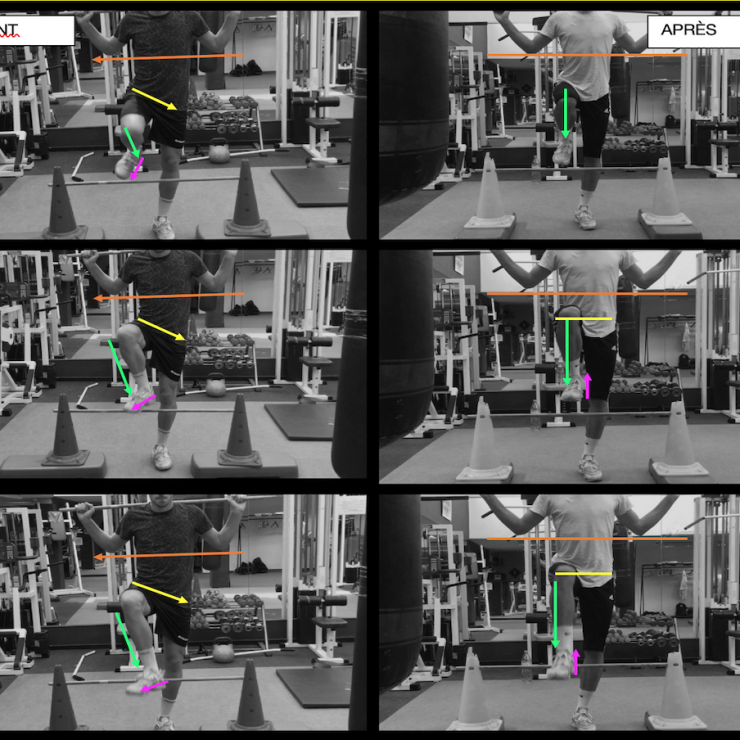 FMS - Hurdle step JD